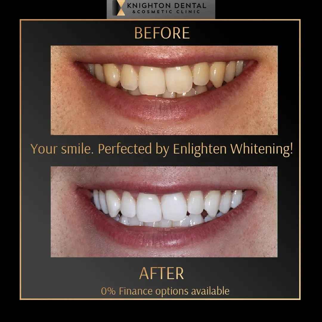 Knighton Dental & Cosmetic Clinic