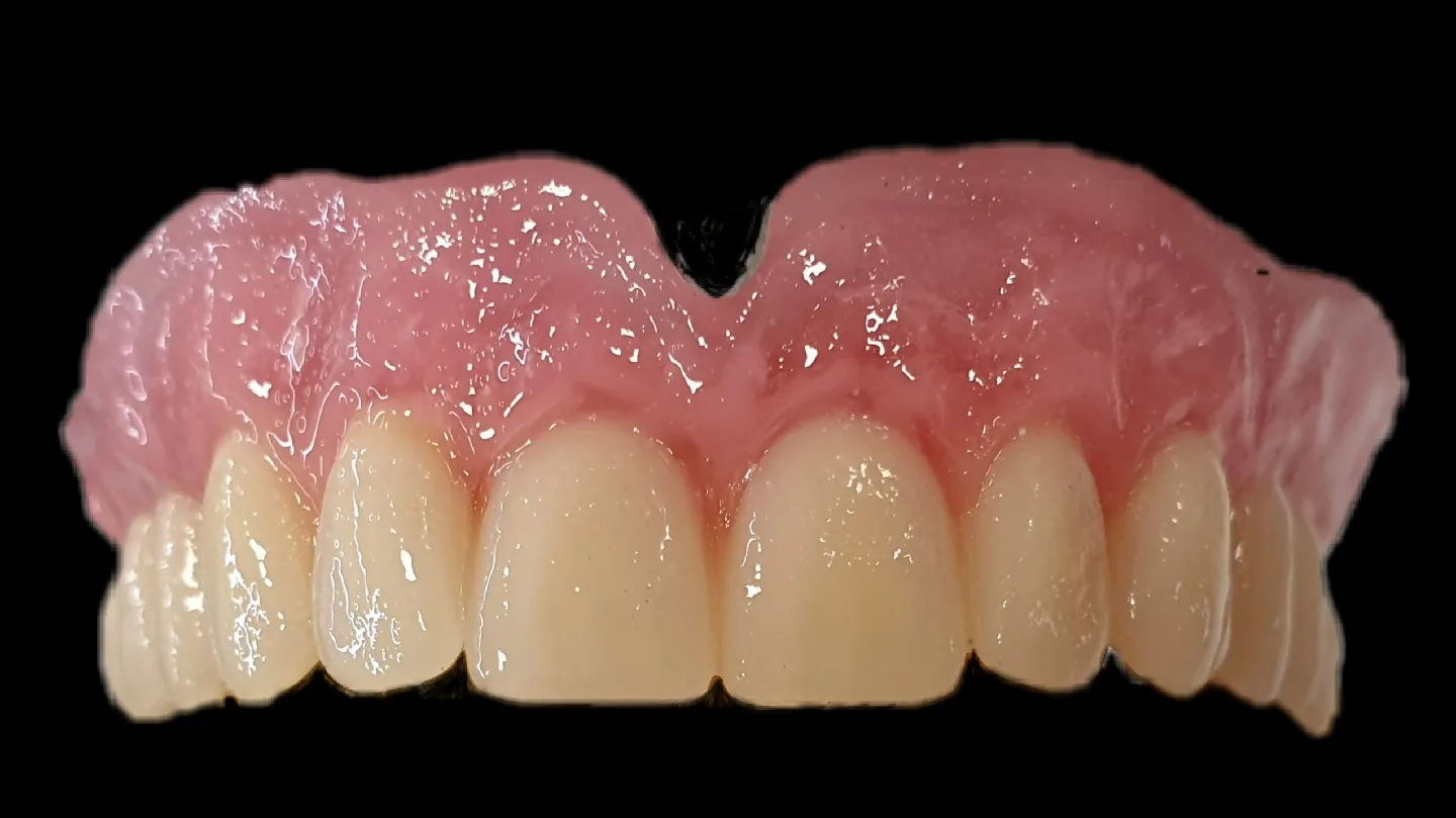AKJ Dentures Ltd - dental laboratory (denture repair, naprawa protez)