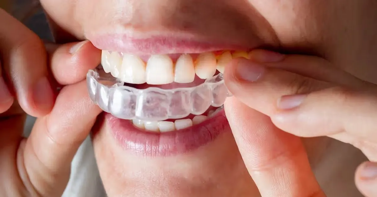 Invisalign Dentist Leicester