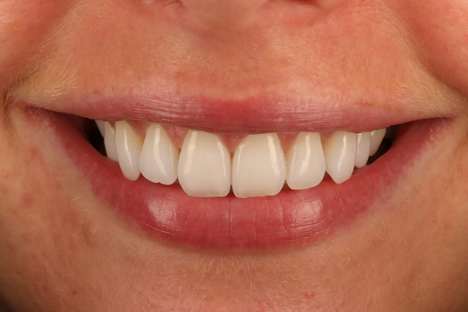 The Dental Edit