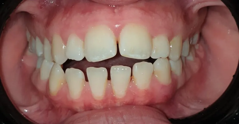 Thurmaston Dental & Implant Studio